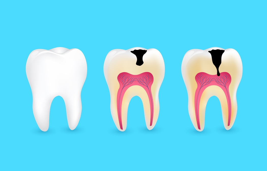 tooth