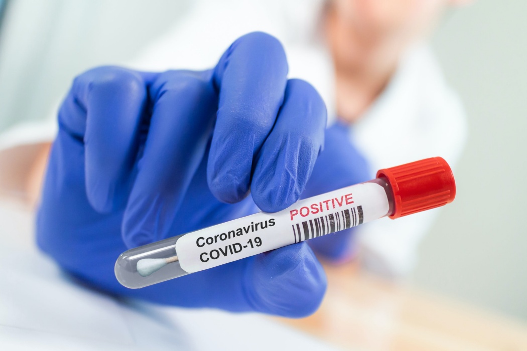 Coronavirus Infected Swab Sample in Doctor Hands. COVID-19 Epidemic and Virus Outbreak.