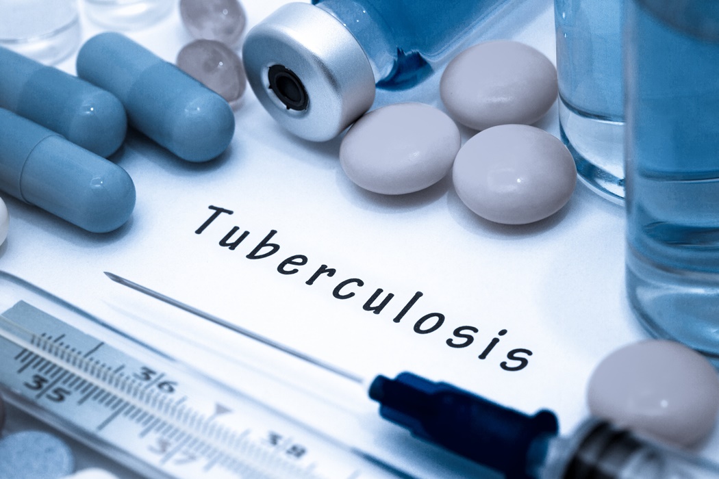 tuberculosis
