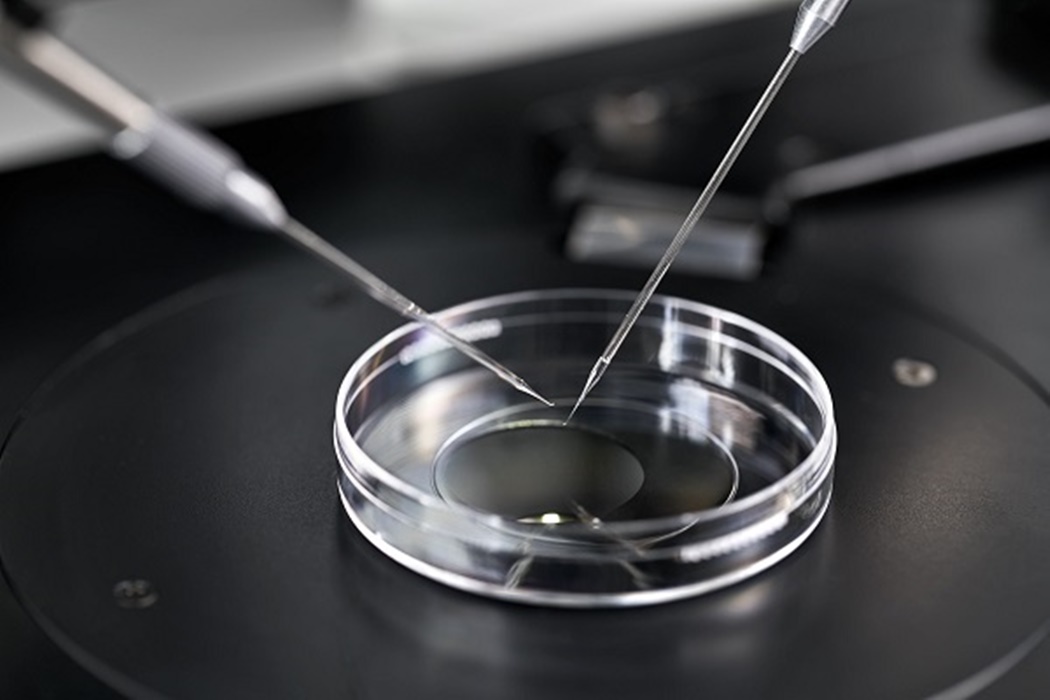 Process of in vitro fertilization in laboratory