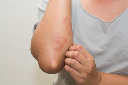 sensitive skin