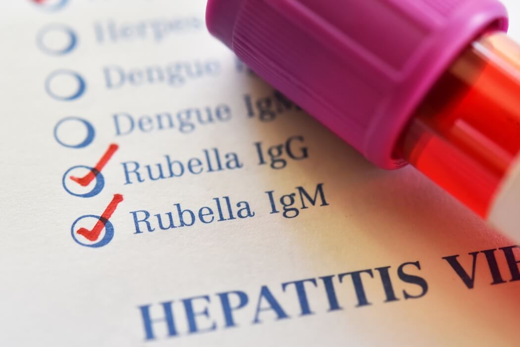 rubella test