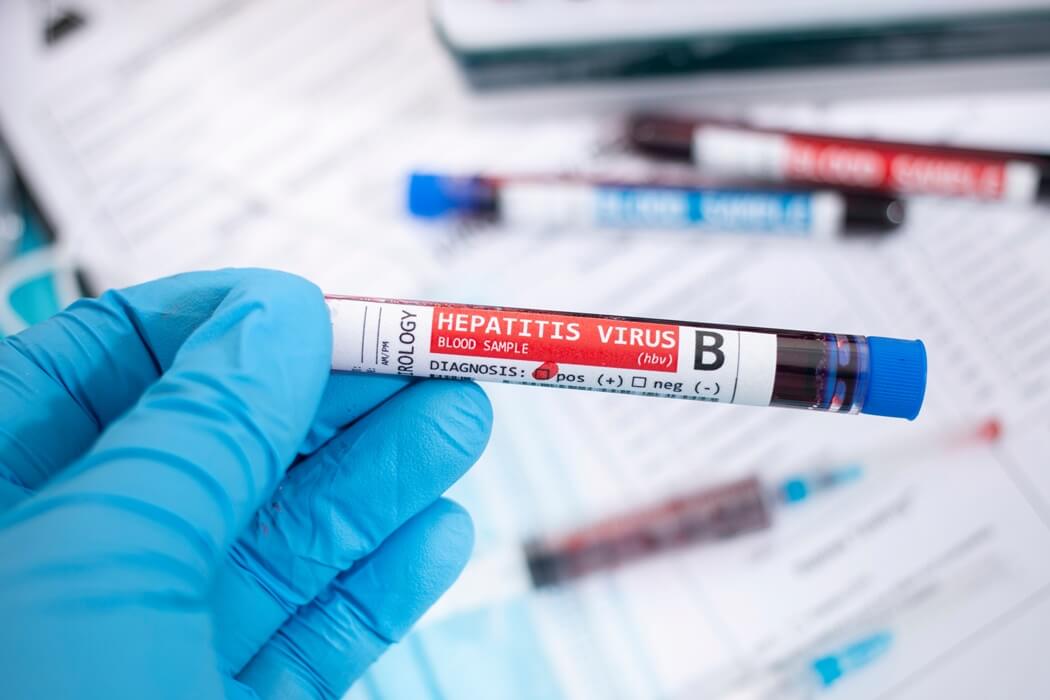 hepatitis test